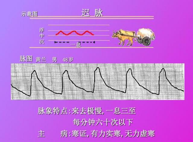 左寸遲者,陰寒在心,寒凝心脈,胸陽不振,而心痛停凝,治以瓜蔞薤白白酒