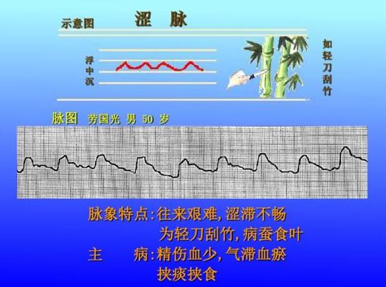 脉诊图解大全28种脉象让你快速掌握脉诊