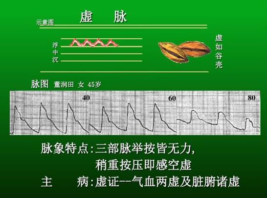 脉诊图解大全28种脉象让你快速掌握脉诊
