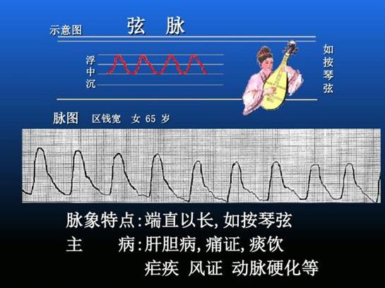 浮弦脉图片