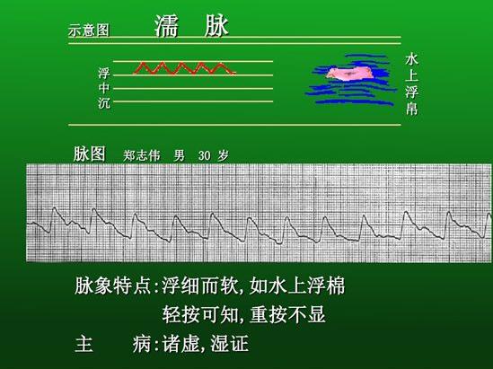 脉诊图解大全28种脉象让你快速掌握脉诊