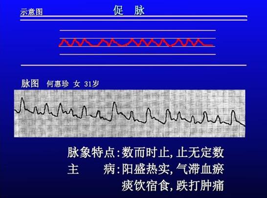 脉诊图解大全28种脉象让你快速掌握脉诊