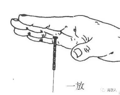 针灸手法如何在针灸时快速得气