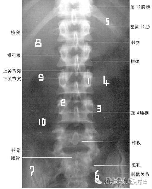 正常腰椎x光片图 图解图片
