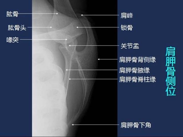 一篇常規x線影像解剖大全總結送給你