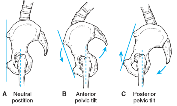 2)后倾当骨盆在髋关节的轴线后方旋转,髂后上棘的骨盆向后方和下方
