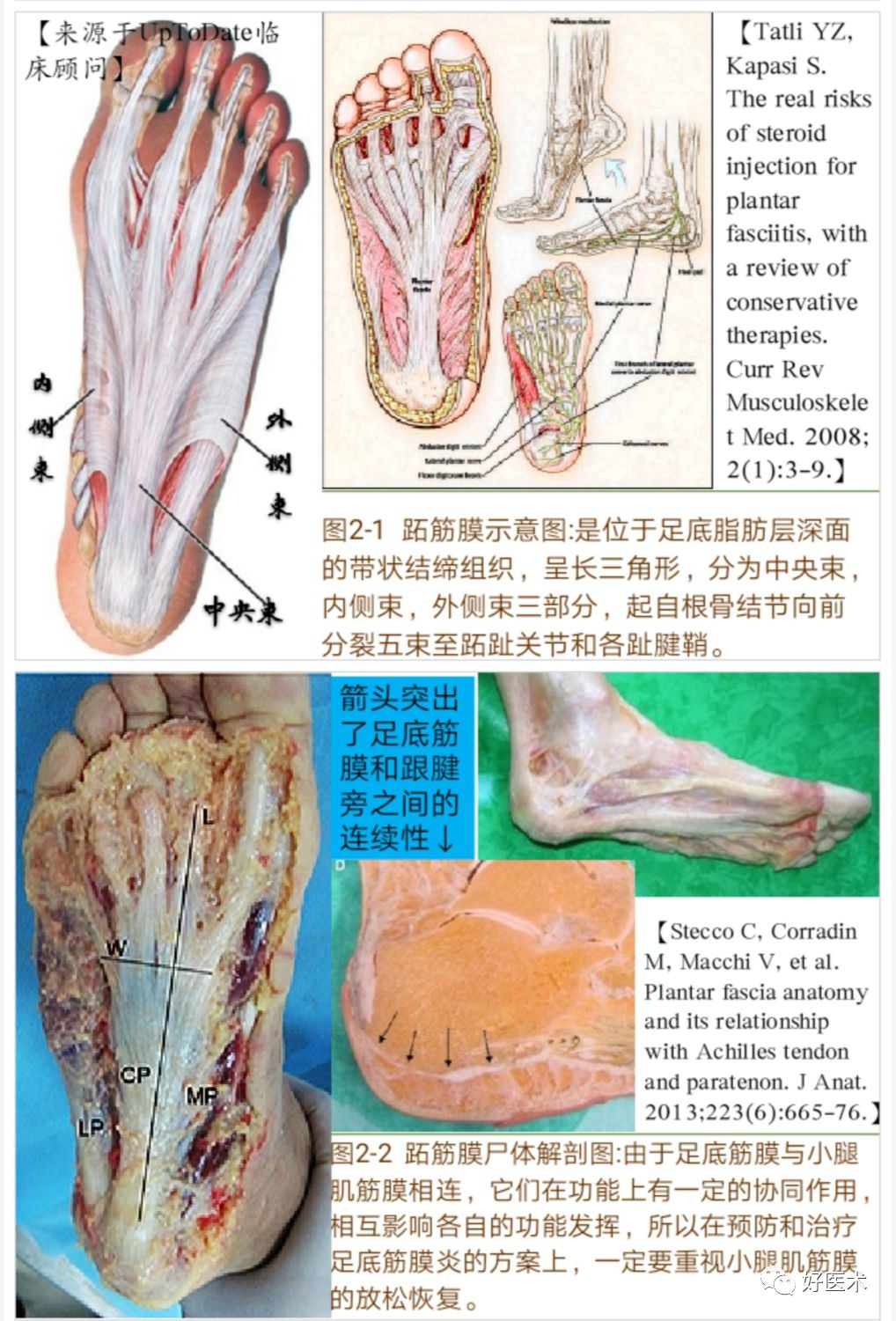 跖腱膜解剖图片