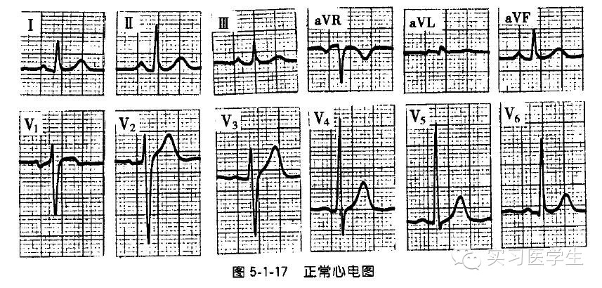 實習醫生必備正常心電圖是什麼樣的