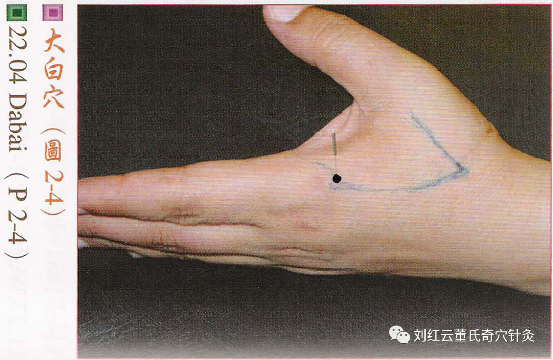 本穴取名「大白」,与肺经关系密切,故治肺病甚效(肺,大肠表里),亦常配