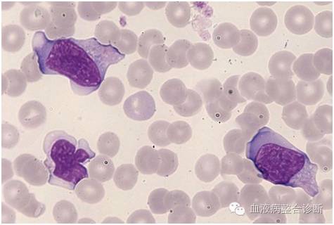 icsh外周血细胞形态特征的命名和分级标准化建议下篇