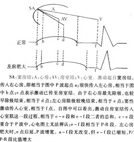 【要訣】左房肥大看寬(圖7).