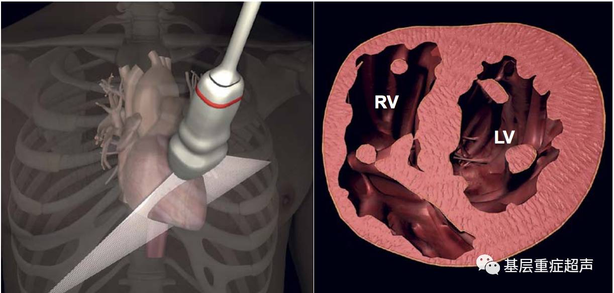 超聲心動圖切面介紹胸骨旁長軸胸骨旁短軸心尖切面劍突下切面