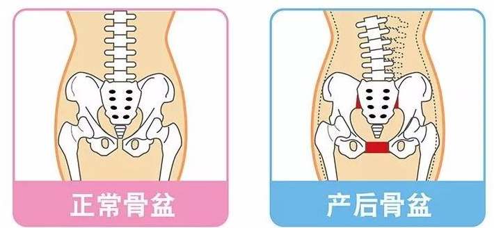 宫颈裂伤分度及示意图图片