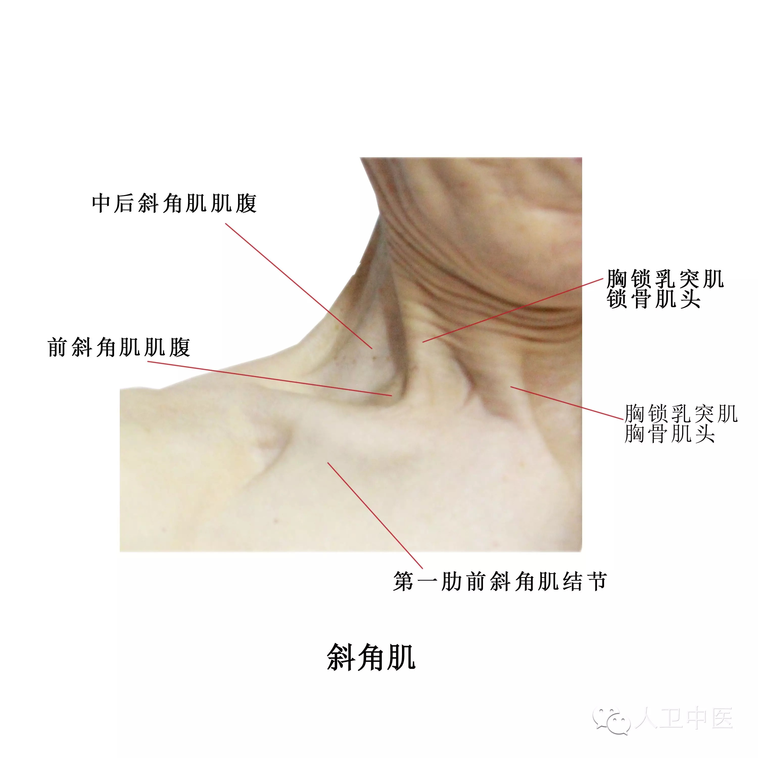 李劍光【按】本篇文章介紹了人體頭頸部相應骨骼體表標誌和肌性標揪