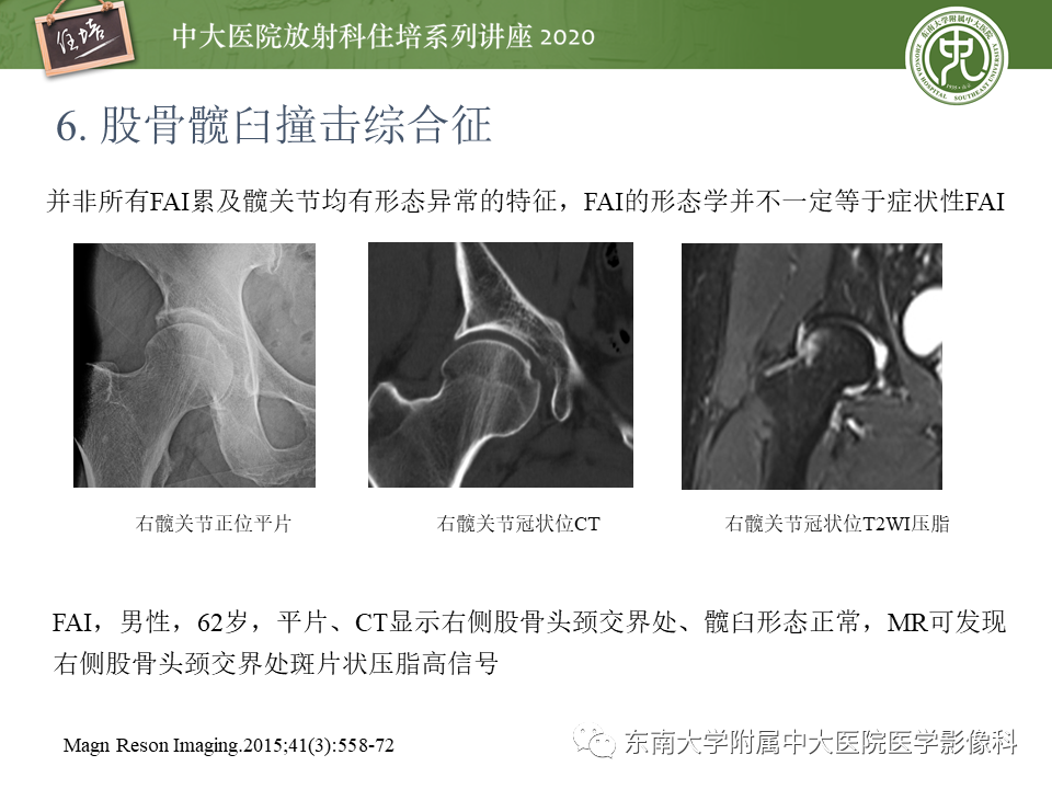 常见撞击综合征的影像诊断